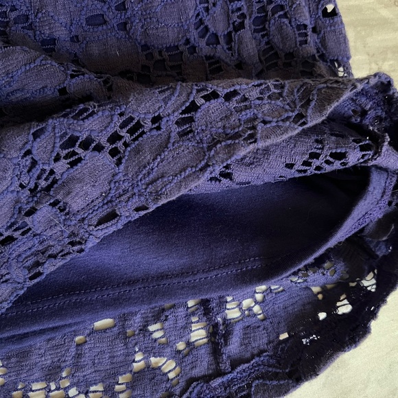 XS Urban Outfitters Pins & Needles lace dress - Picture 5 of 6